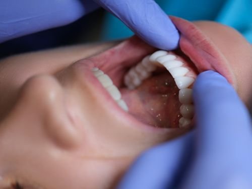 Oral Surgery Services in South Yarra at All Smiles Dental Studio