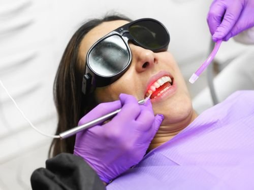 Laser Therapy Services in South Yarra at All Smiles Dental Studio