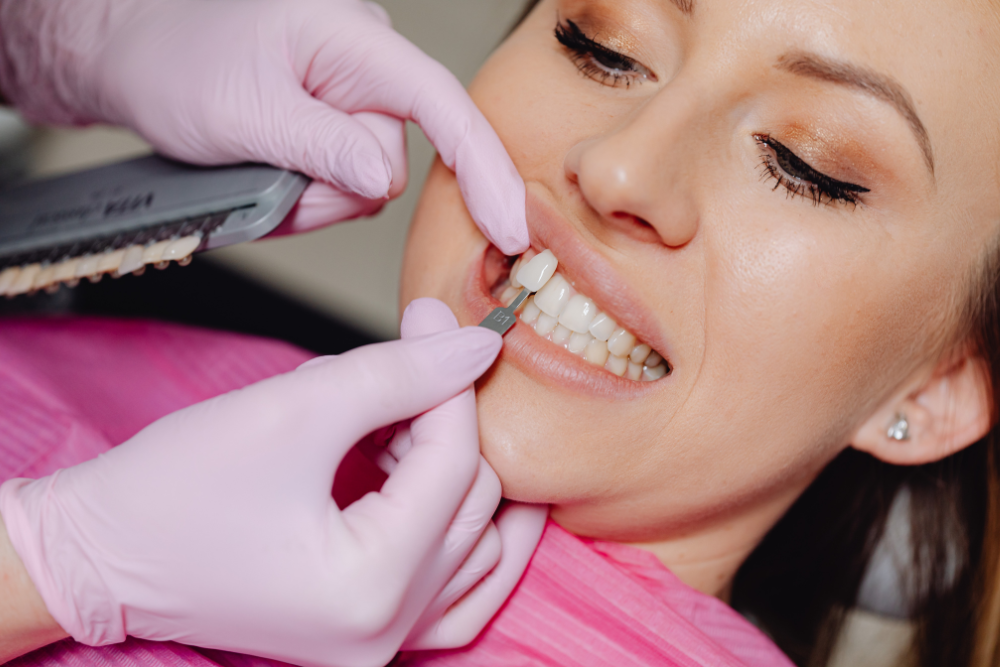 You are currently viewing Dental Veneers Process: Your Step-by-Step Guide