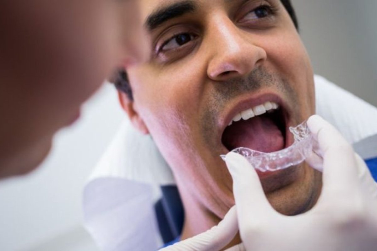 Invisalign aligners being worn in Hampton dental clinic