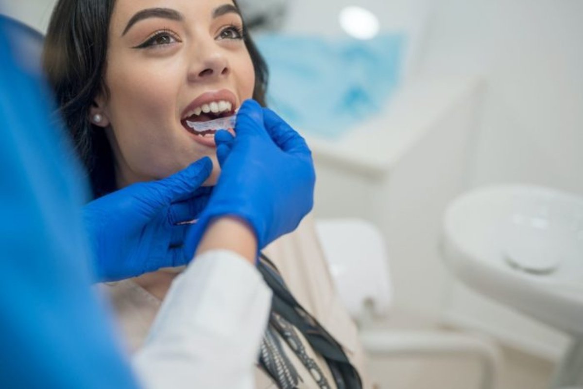 Clear aligners being worn at Murrumbeena dental clinic