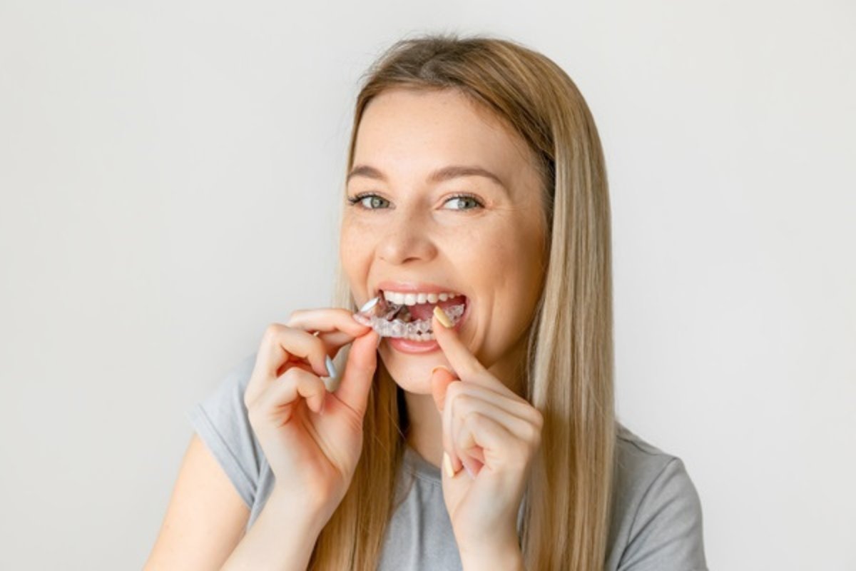 Patient wearing Invisalign clear aligners near Armadale