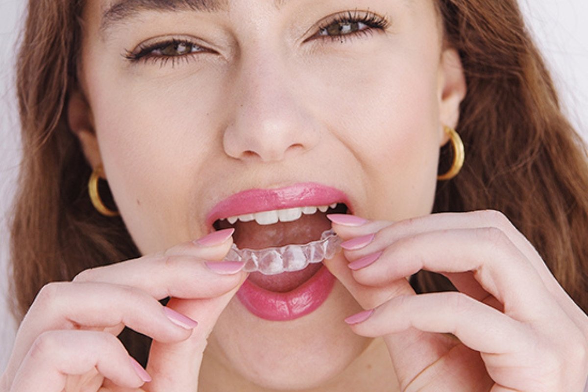 Patient wearing Invisalign clear aligners near Balaclava