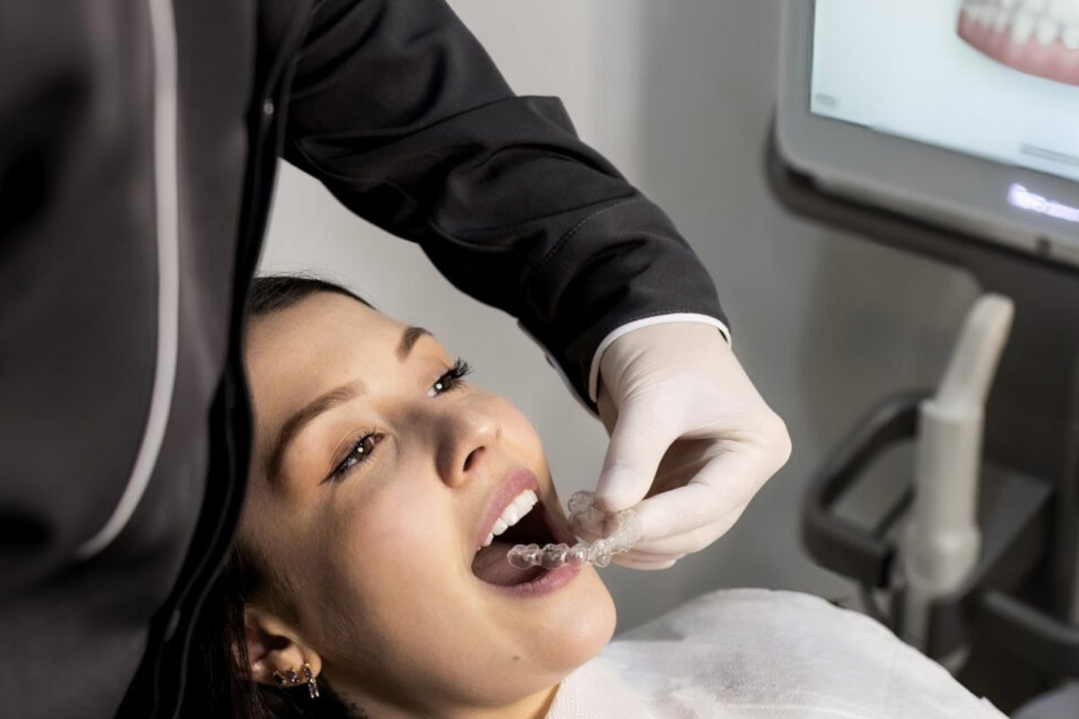ClearCorrect aligner fitting at Bittern dental clinic