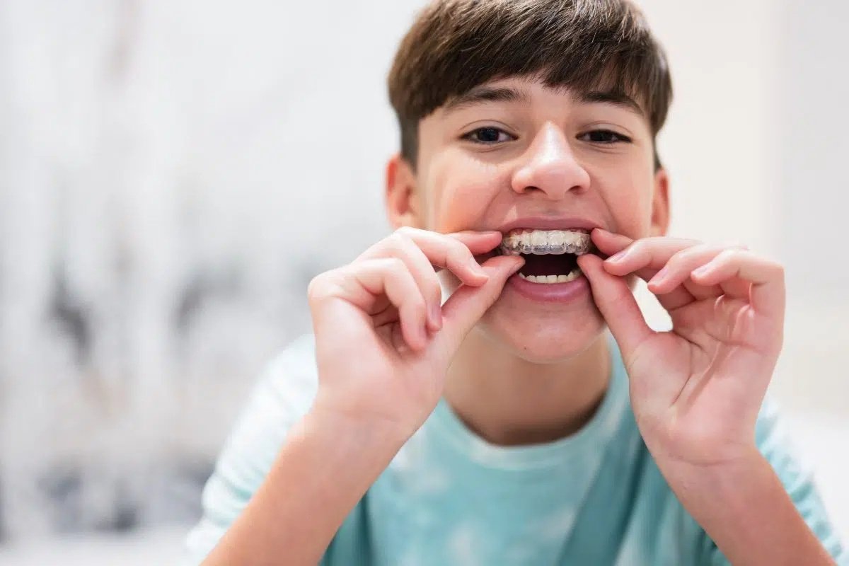 clear-aligners-treatment-cranbourne-south