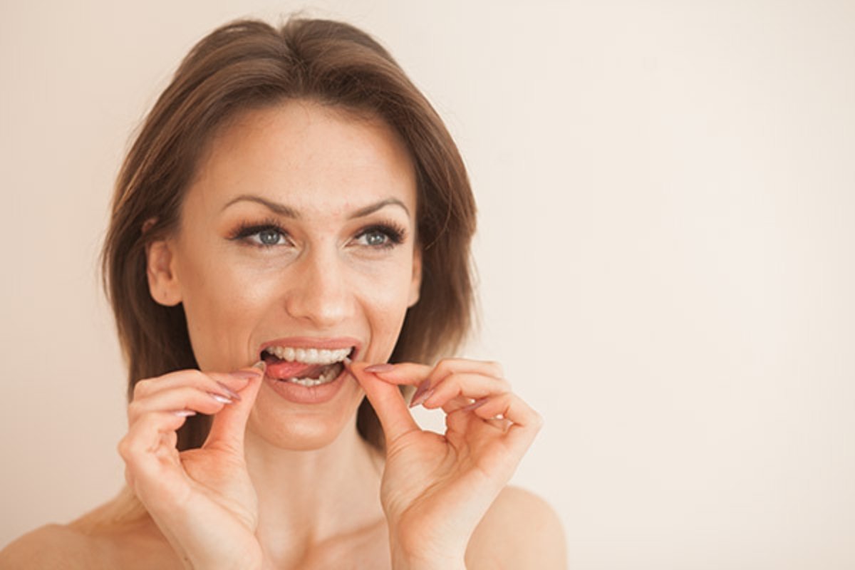 Clear aligners fitted at Frankston North dental clinic