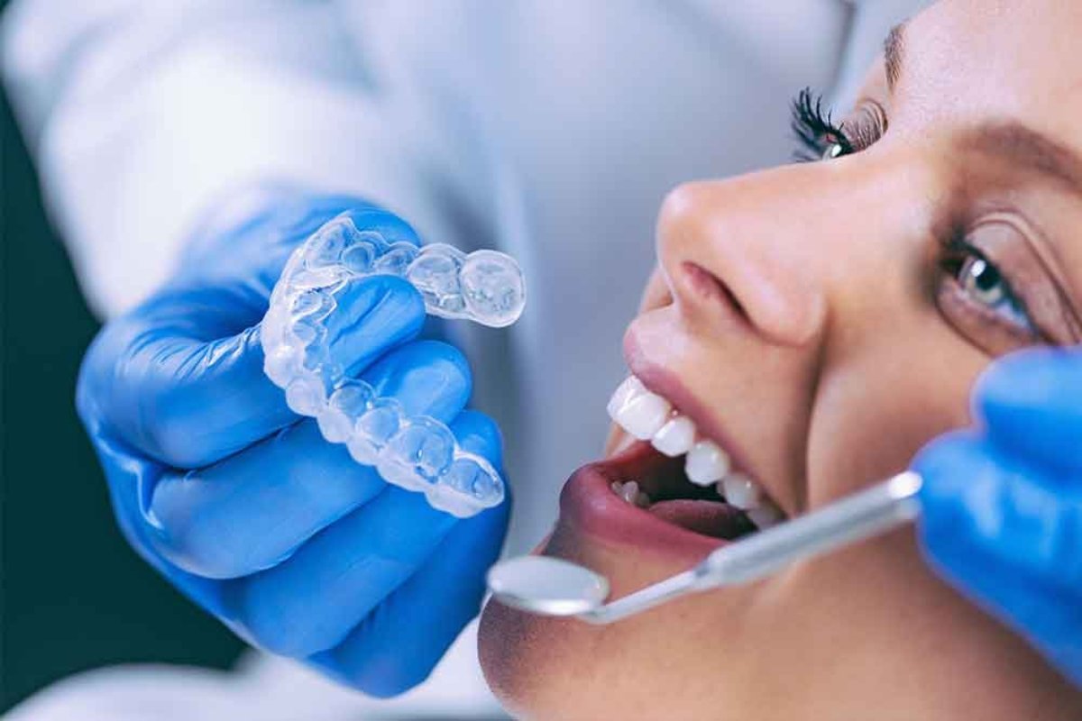 Invisalign aligners being worn in Frankston South dental clinic
