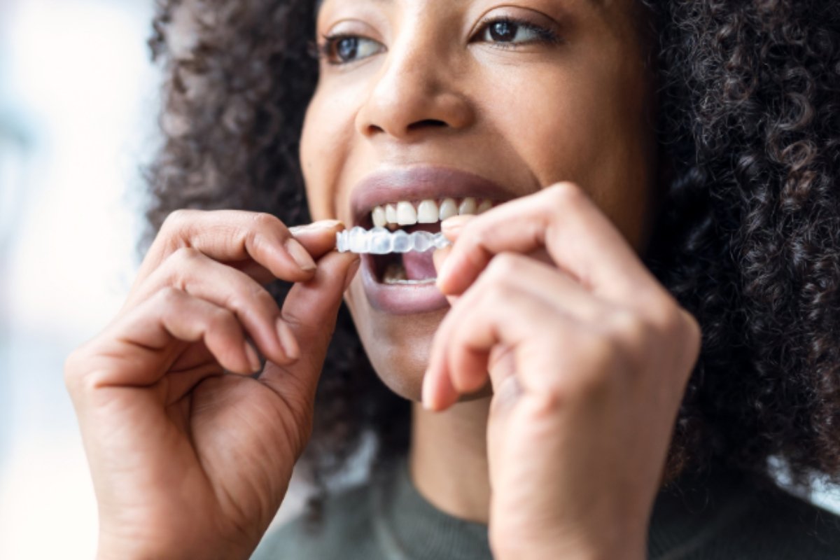 Invisalign aligners being worn in Mount Eliza dental clinic