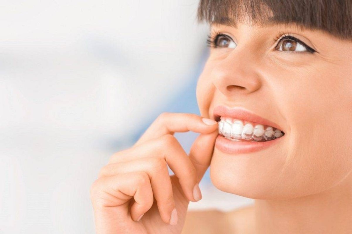 Invisalign treatment in St Kilda East at dental clinic