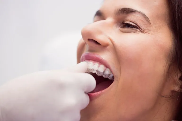 Patient wearing Invisalign clear aligners in Malvern East