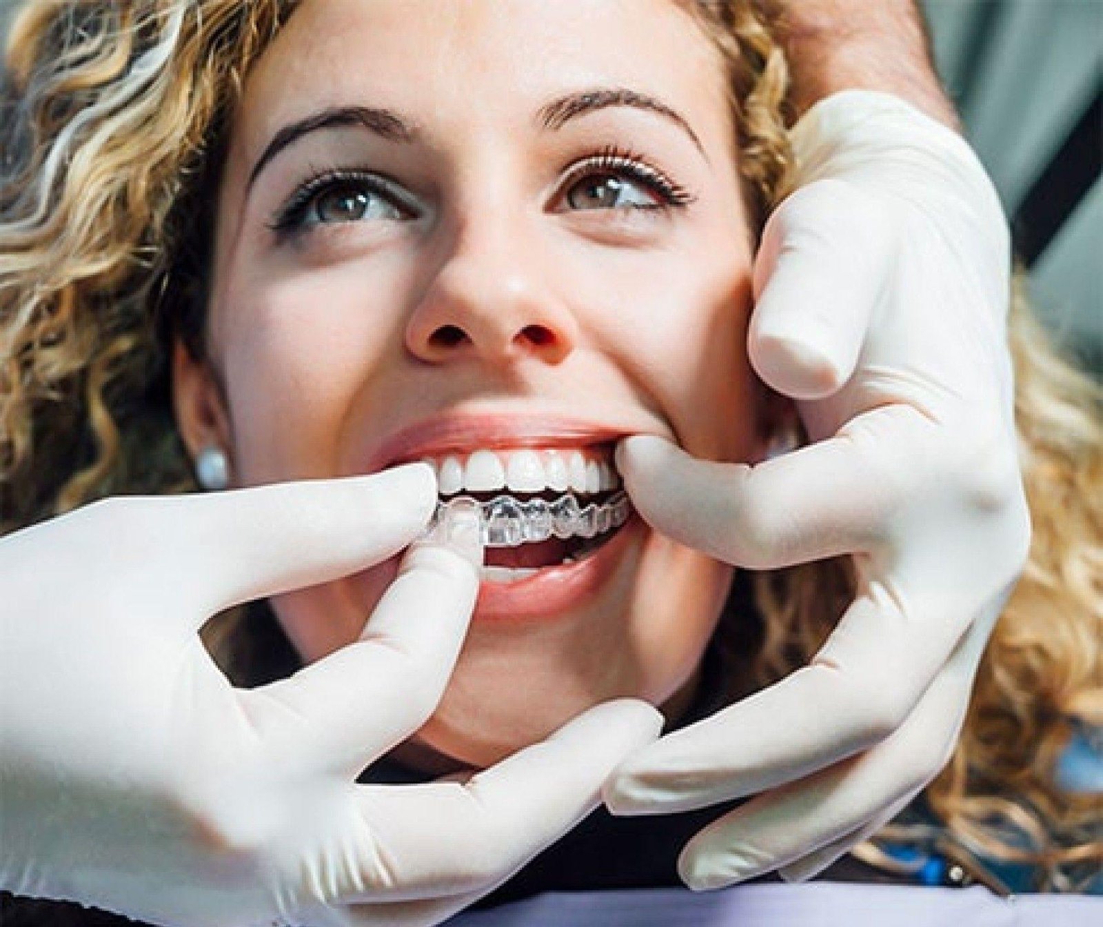 ClearCorrect aligners fitted near Hawthorn East