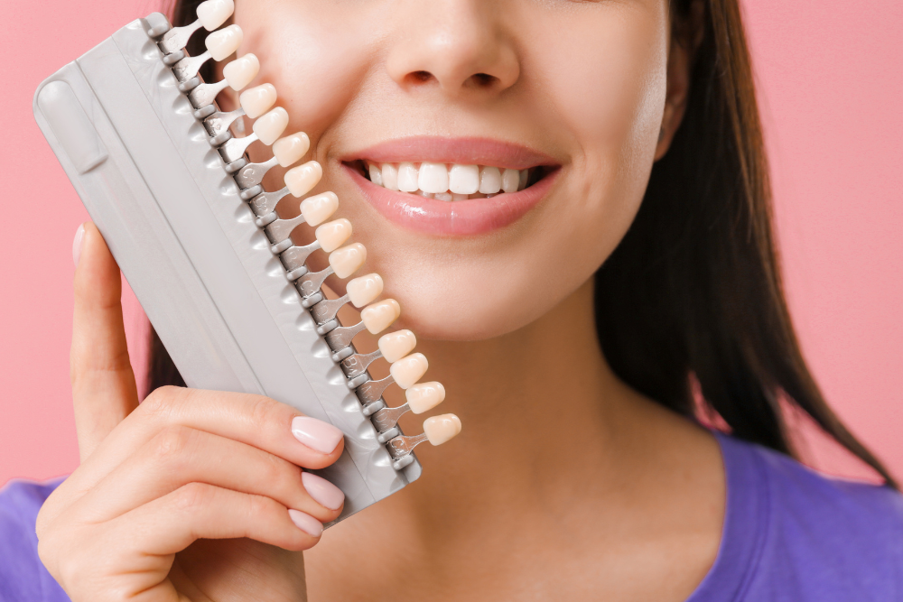 You are currently viewing Veneers: Repair Chipped & Broken Teeth for a Perfect Smile