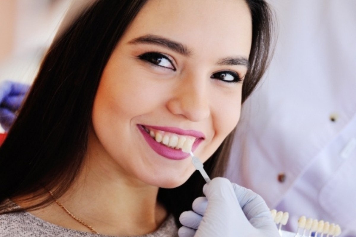 Dentist applying veneers near Armadale, Victoria
