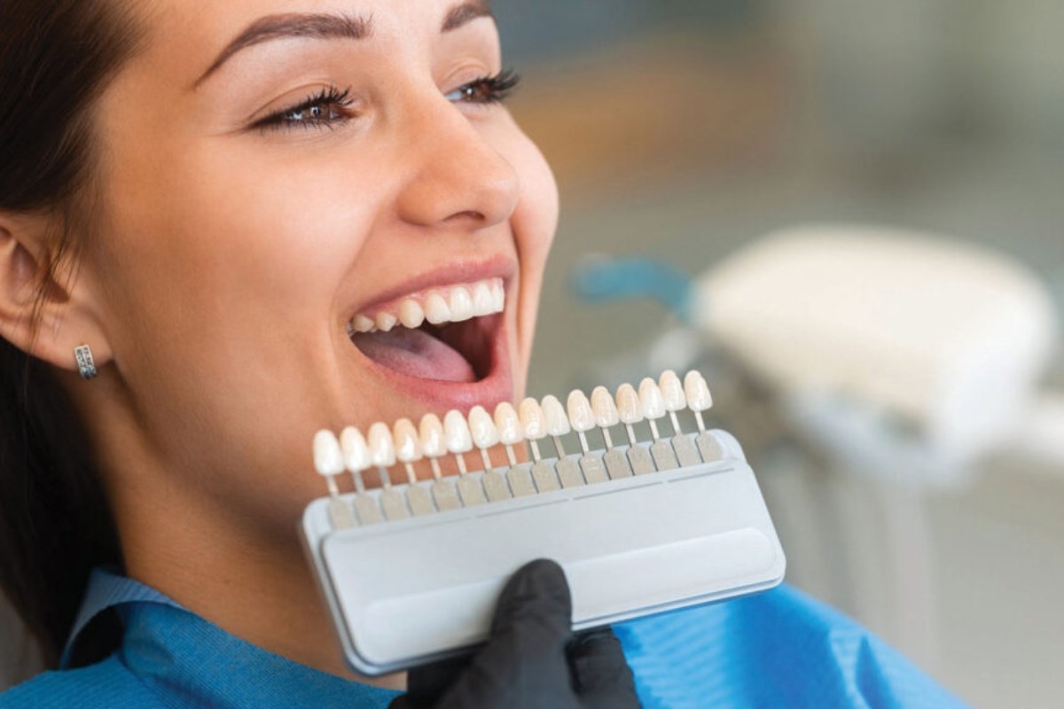 Veneers treatment at a dental clinic near Brighton, Victoria