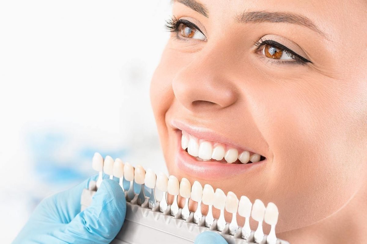 Dental veneers application near Cranbourne South dental clinic