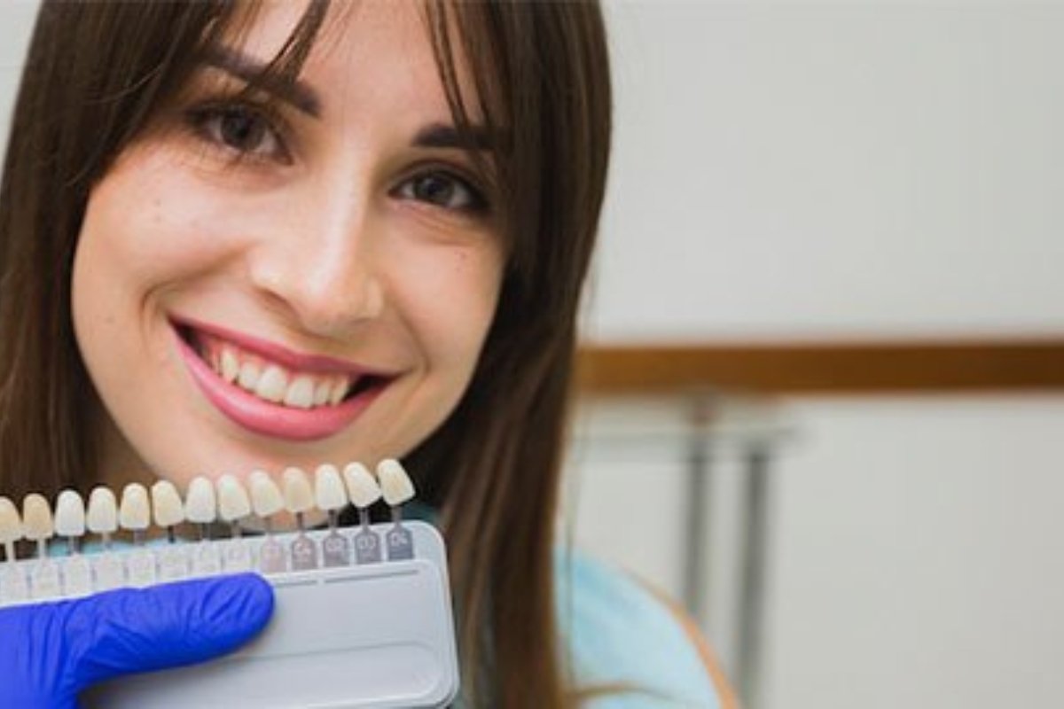 Dentist applying veneers near Frankston South