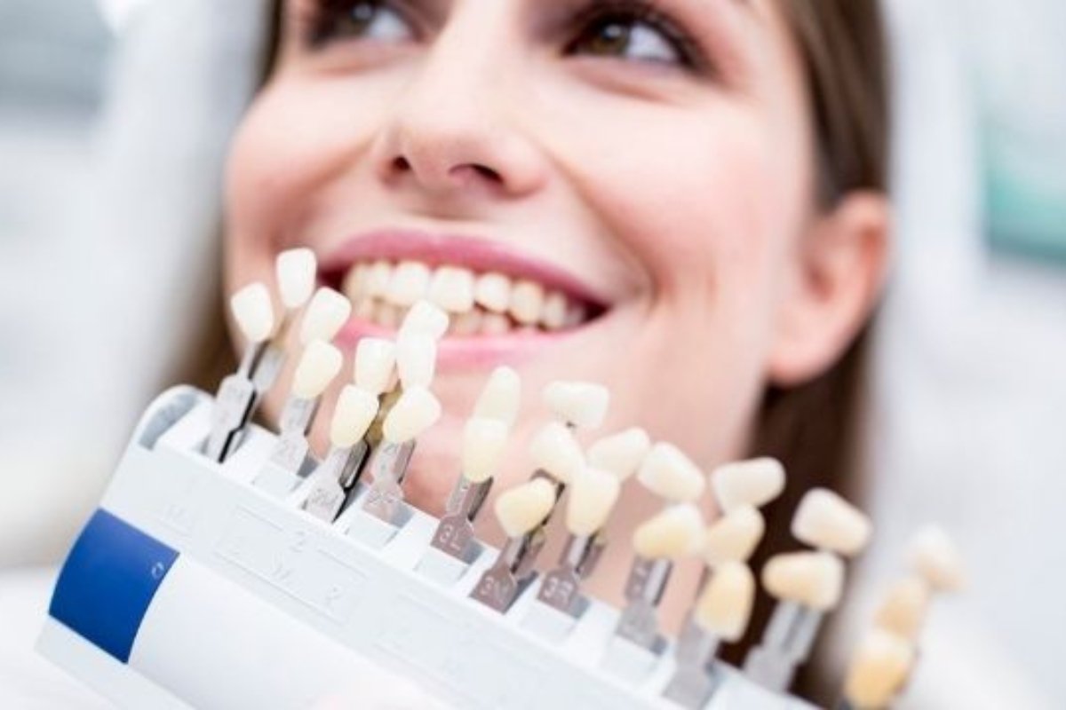 Dentist applying veneers near Hawthorn, Victoria