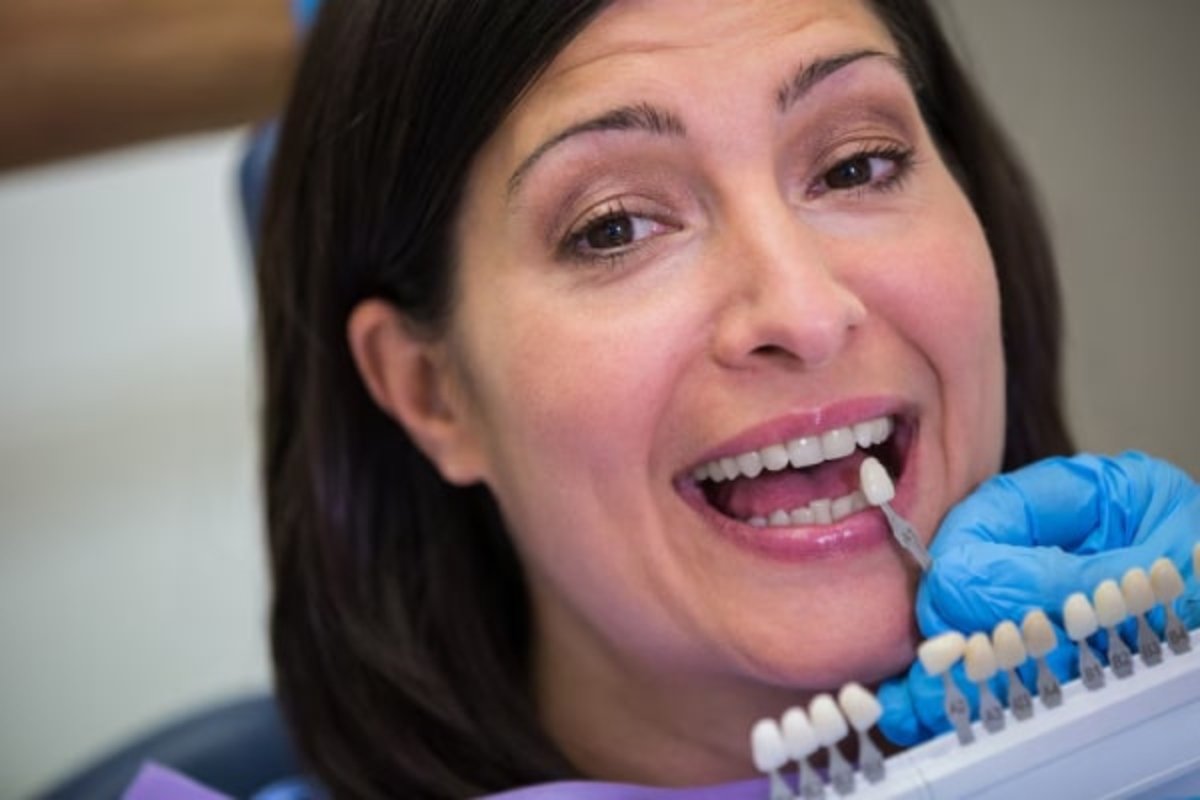 Dentist performing veneers procedure near Oakleigh, Victoria