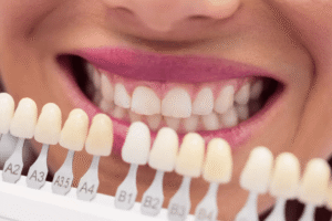 Read more about the article Veneer Myths Debunked: Get the Facts!
