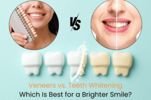 Read more about the article Veneers vs. Whitening: Which Smile Fix Wins?