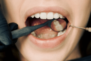 Read more about the article What Your Teeth Say About You (According to Dentists)