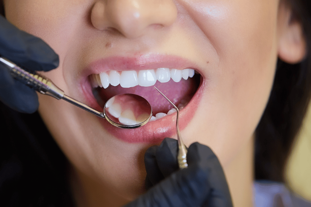 You are currently viewing The One Dental Appointment That Could Save You Thousands Later