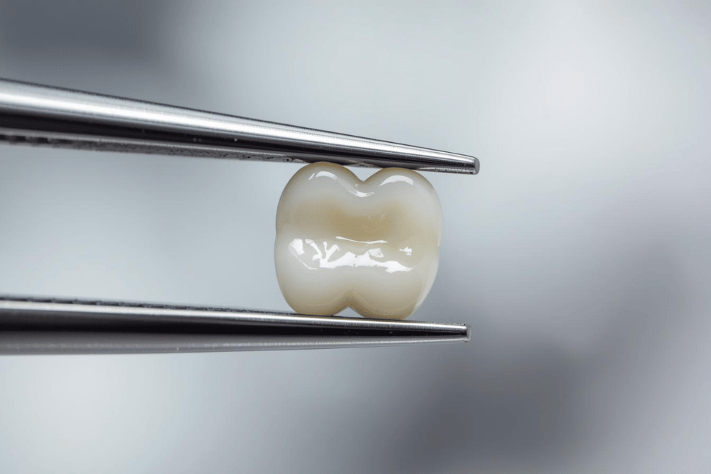 You are currently viewing Inlays and Onlays: When a Filling Isn’t Enough, but a Crown is Too Much