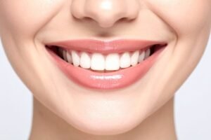 Read more about the article Porcelain Veneers: The Ultimate Smile Transformation