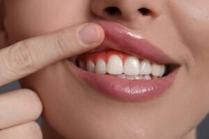 Read more about the article More Than a Pretty Face: The Surprising Health Benefits of Straight Teeth