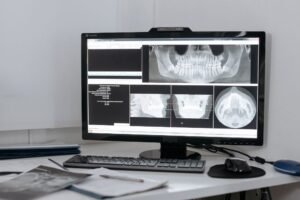 Read more about the article Do I Really Need My Wisdom Teeth Removed? The Proactive Approach