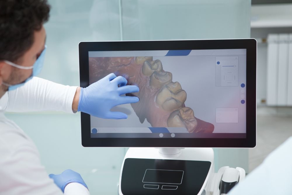 High-Tech Smiles: The Science and Precision of Clear Aligners