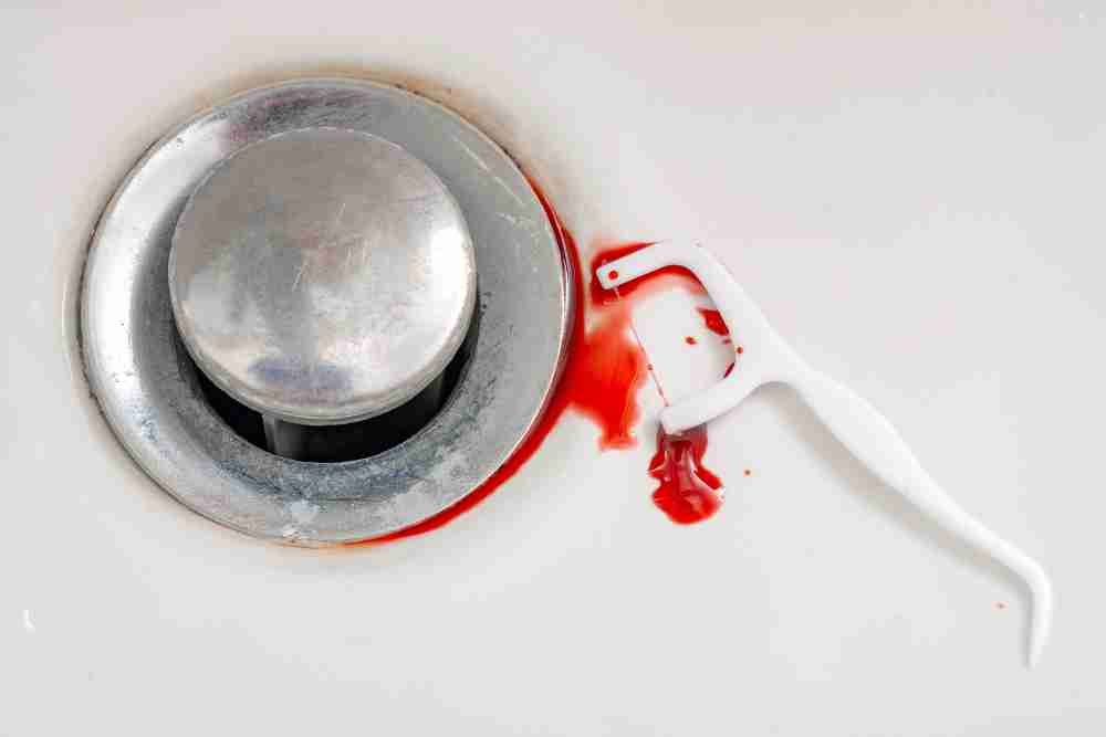 Pink in the Sink: The Real Reasons Your Gums Bleed When You Floss